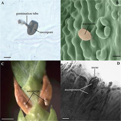 Histological, chemical and gene expression differences between western redcedar seedlings resistant and susceptible to cedar leaf blight